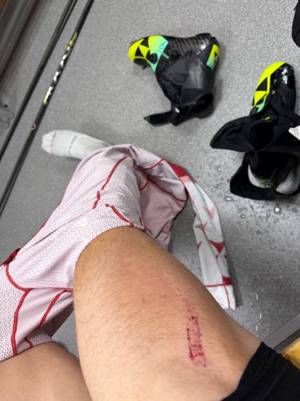 Федерация лыжных гонок России назвала недопустимой недавнюю ситуацию между спортсменами на Кубке России — Александр Большунов сбил с ног лыжника Александра Бакурова