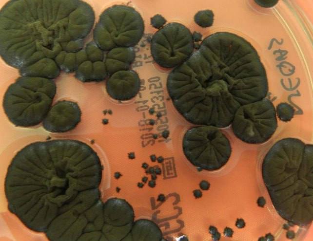 В Чернобыле растет гриб «питающийся» радиацией: В Чернобыле растет гриб «питающийся» радиацией: