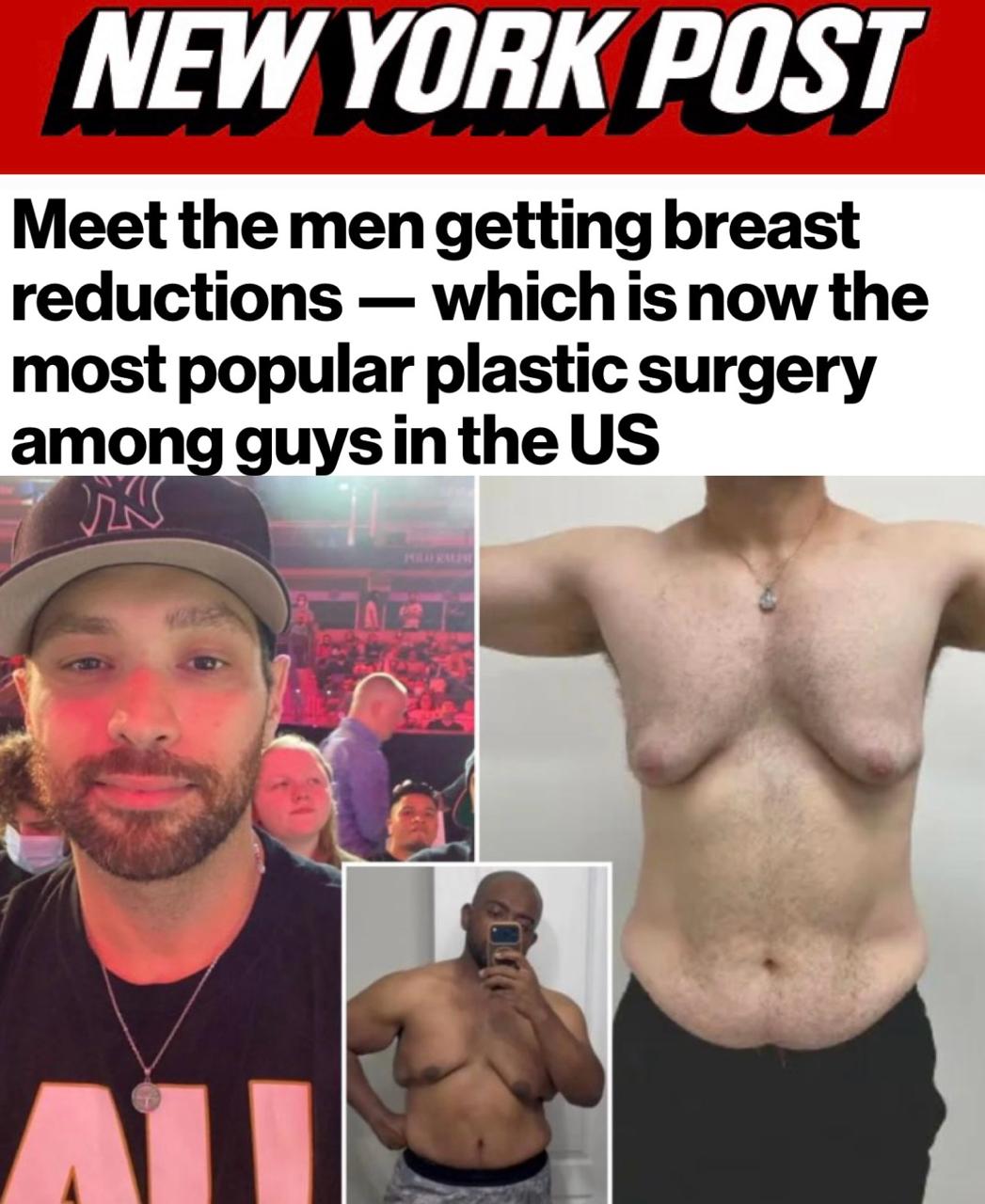 «Уменьшение груди стало самой популярной пластической операцией среди американских мужчин»: А вовсе не увеличение чего вы подумали