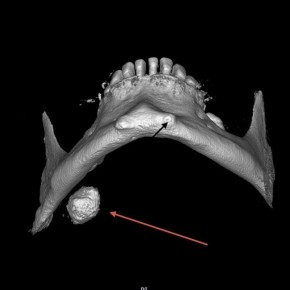 ������� ������ ������ �������� 17 ���