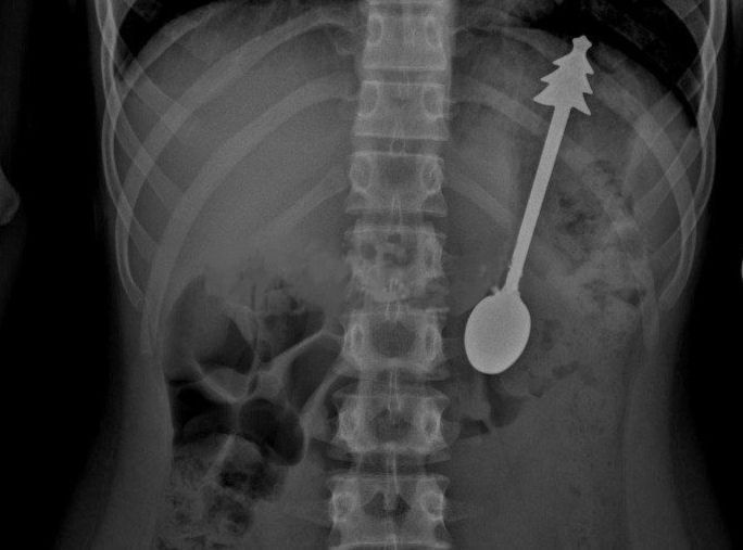 ������� �������� ��������� 14-������������� ����� � ���������