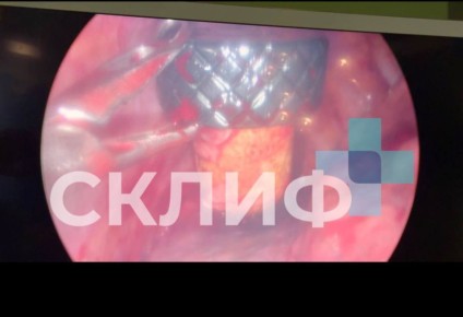 ������ �� ������� ������� �� ������ � ��� ��������������