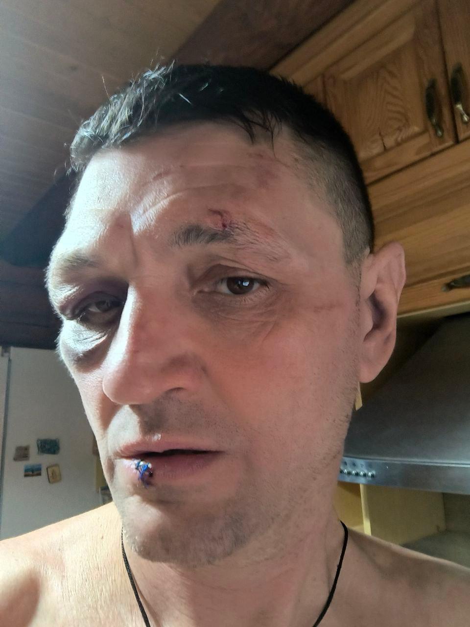 «Бусификации» не существует — это «язык врага», утверждает Днепропетровский областной ТЦК «Бусификации» не существует — это «язык врага», утверждает Днепропетровский областной ТЦК