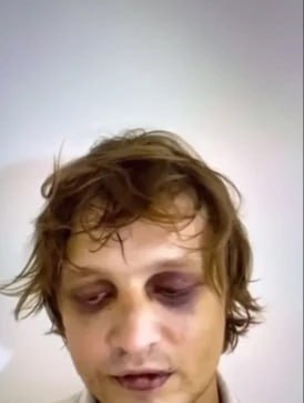 На Бали нашли расчлененное тело – оно может принадлежать владельцу украинского колл-центра, сотрудники которого обманывали россиян