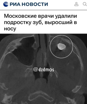 ����������� ����� ������� ��������� ���, �������� � ����: ��������� ��� ���� ������ ������