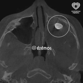 ��� � ���� � ��������� ������� ���������� �����